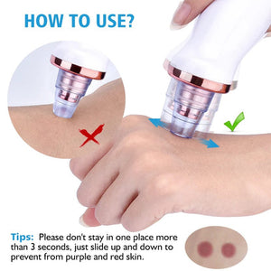Electric Pore Cleaner & Blackhead Remover – Face Vacuum Suction Tool
