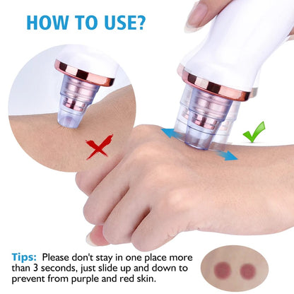 Electric Pore Cleaner & Blackhead Remover – Face Vacuum Suction Tool