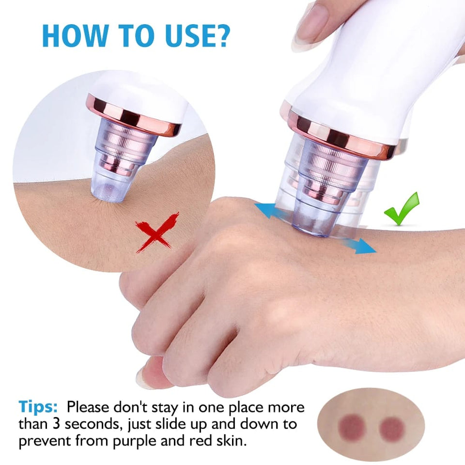 Electric Pore Cleaner & Blackhead Remover – Face Vacuum Suction Tool