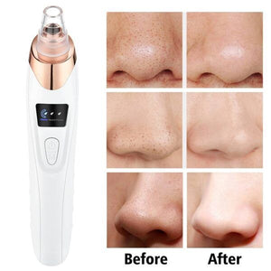 Electric Pore Cleaner & Blackhead Remover – Face Vacuum Suction Tool