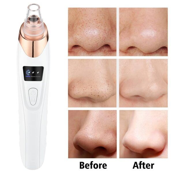 Electric Pore Cleaner & Blackhead Remover – Face Vacuum Suction Tool