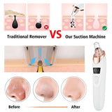 Electric Pore Cleaner & Blackhead Remover – Face Vacuum Suction Tool
